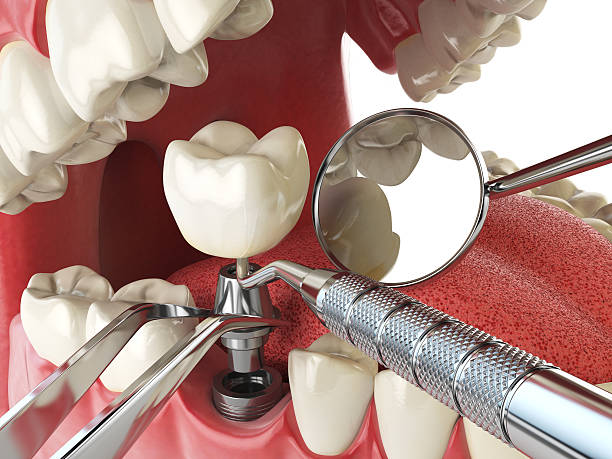 Best Same-Day Emergency Dental Services in La Vale, MD